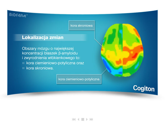 cogiton, biofarm, choroba alzheimera, prezentacja medyczna, prezentacja multimedialna, projekt prezentacji